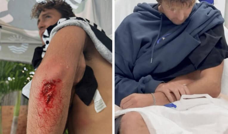 Crosby Colapinto (pictured) suffering.